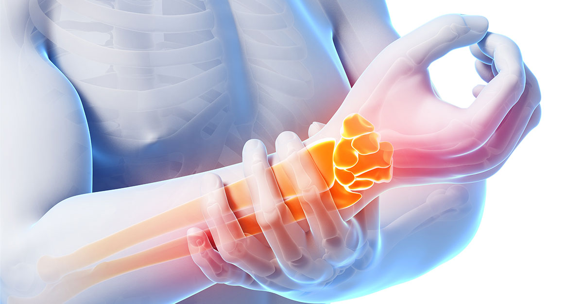 Shawnee natural carpal tunnel treatment